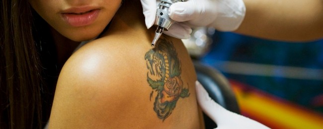 как удаляются татуировки